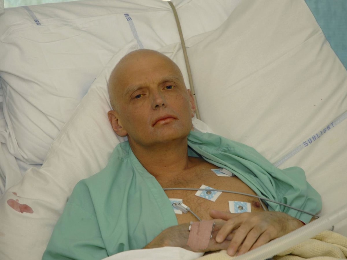 Umírající Alexandr Litviněnko. Agent byl otráven radioaktivním poloniem.