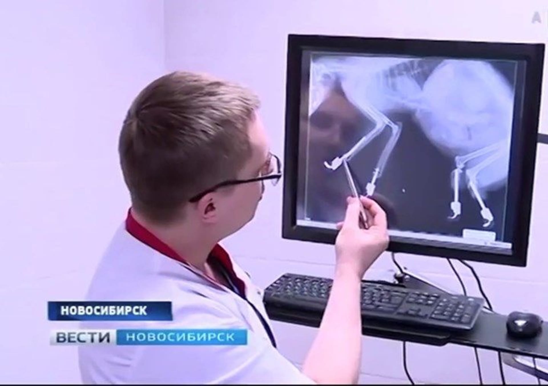 Ryžikův ošetřující lékař ukazuje, jak jsou protézy přichyceny.