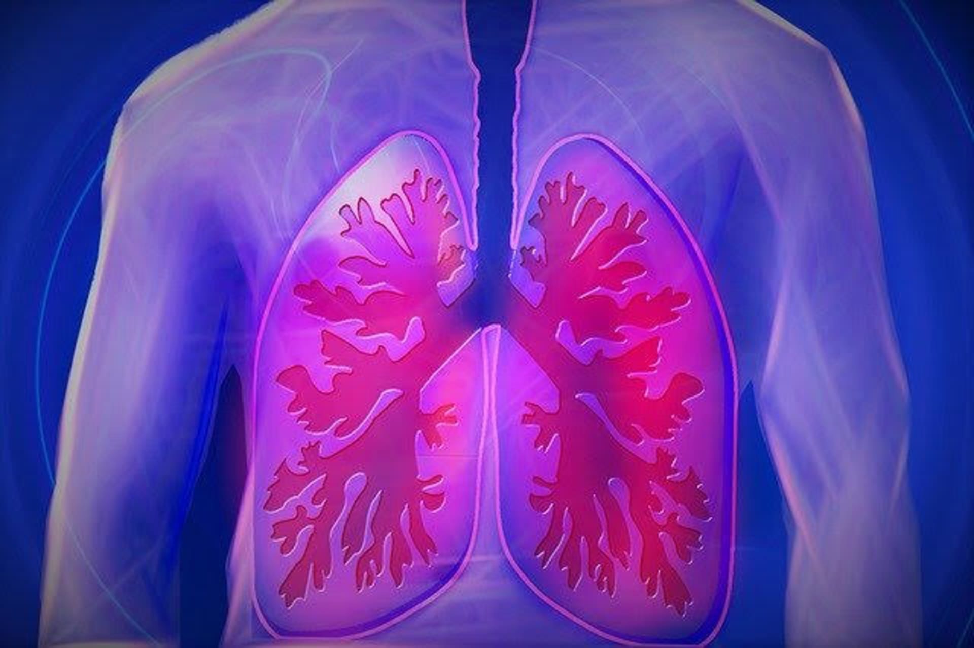 Skrytou tuberkulózu lékaři objeví jen v ojedinělých případech