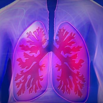 Skrytou tuberkulózu lékaři objeví jen v ojedinělých případech (pixabay)