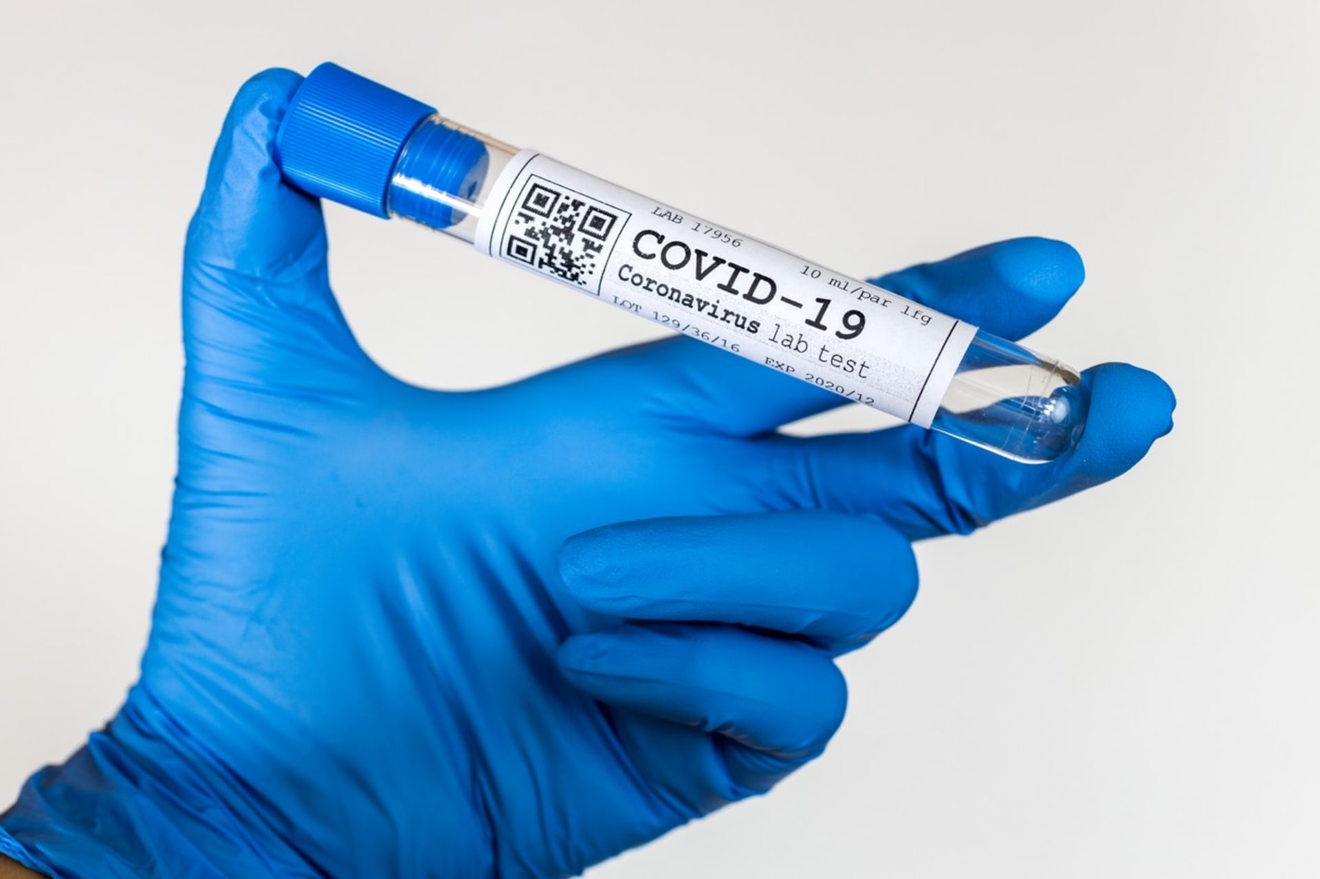 Zda jste, či nejste nakažení, určí spolehlivě až test na koronavirus. 