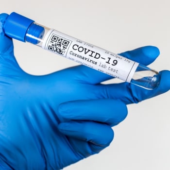 Koronavirus se dá testovat 