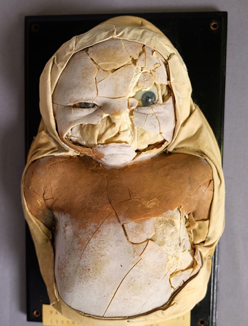 Děsivě poškozenou dětskou voskovou panenkou se blýsklo helsinské univerzitní muzeum.