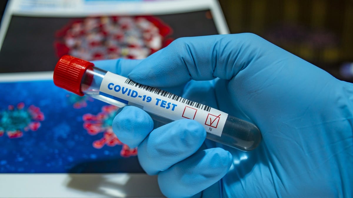 Koronavirus: Vědci pracující na vakcíně hlásí úspěšné pokusy na opicích (ilustrační foto)