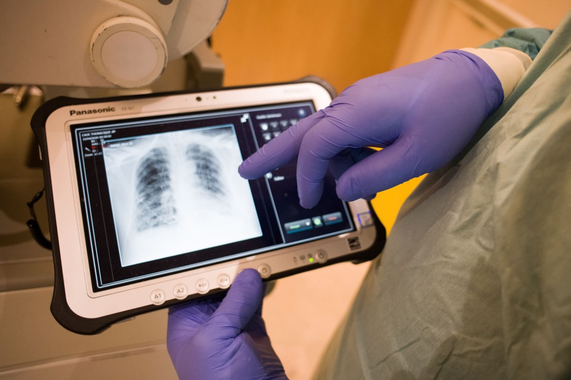 Doktor kontroluje rentgenový snímek plic pacienta nakaženého koronavirem