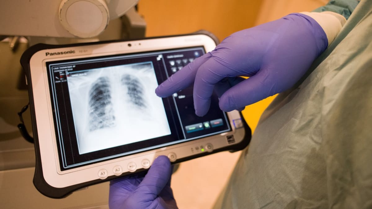 Doktor kontroluje rentgenový snímek plic pacienta nakaženého koronavirem
