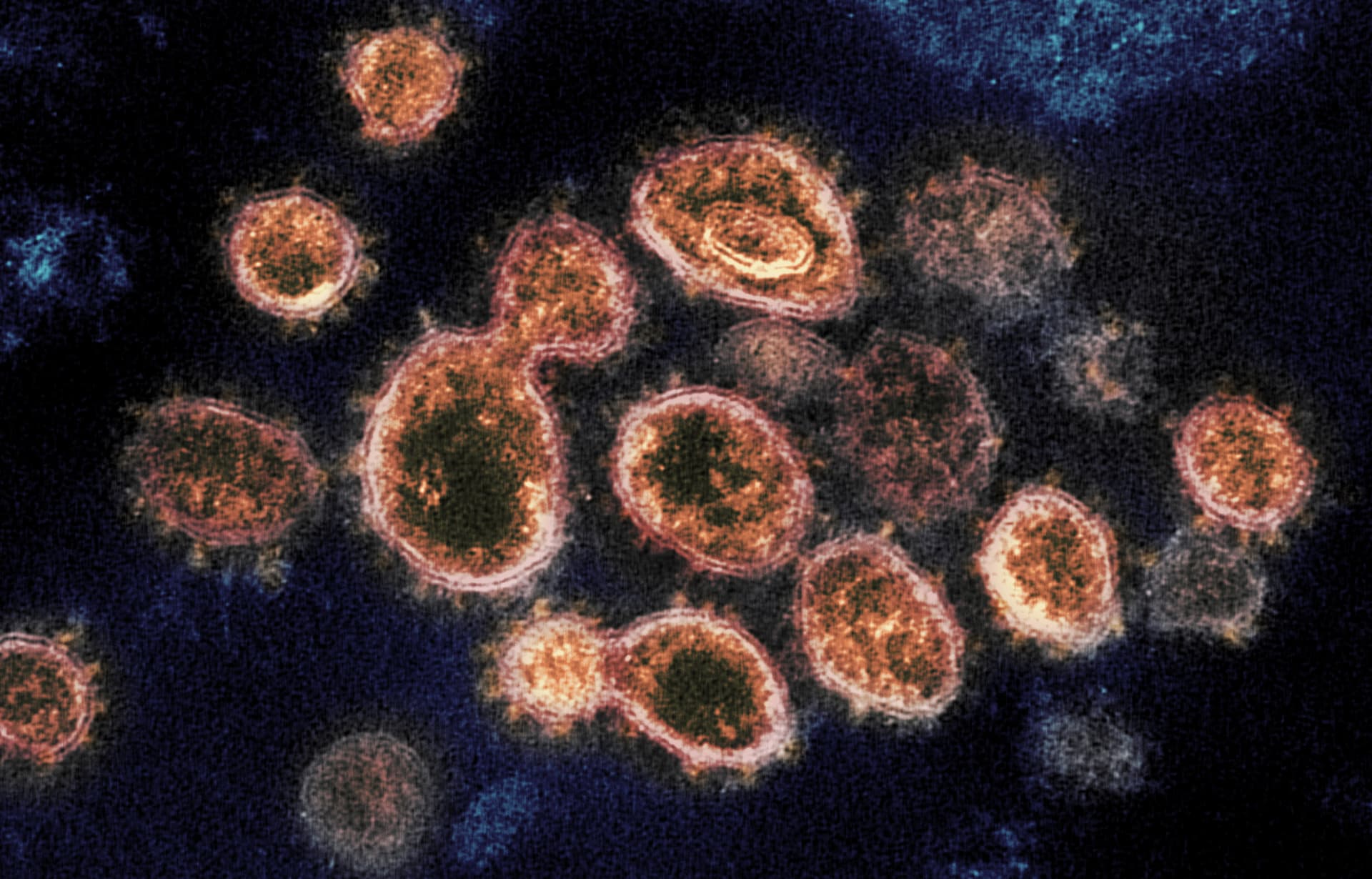 Virus SARS-CoV-2, který způsobuje onemocnění COVID-19