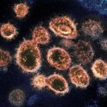 Virus SARS-CoV-2, který způsobuje onemocnění COVID-19
