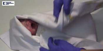 Novorozenec přežil dvě hodiny v lednici na mrtvoly. Doktoři ho omylem odepsali