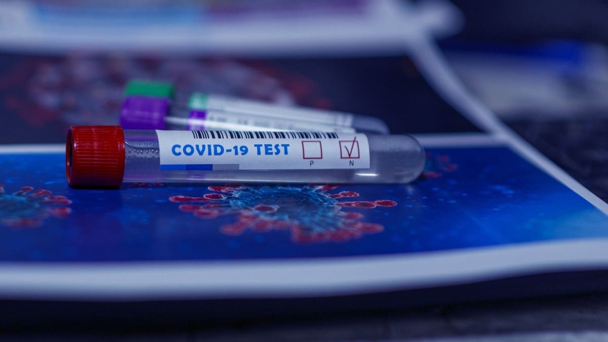 Test na COVID-19