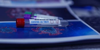 Olomoučtí vědci vyvinuli rychlý a levný test na koronavirus. Mohl by vyjít jen na stovku