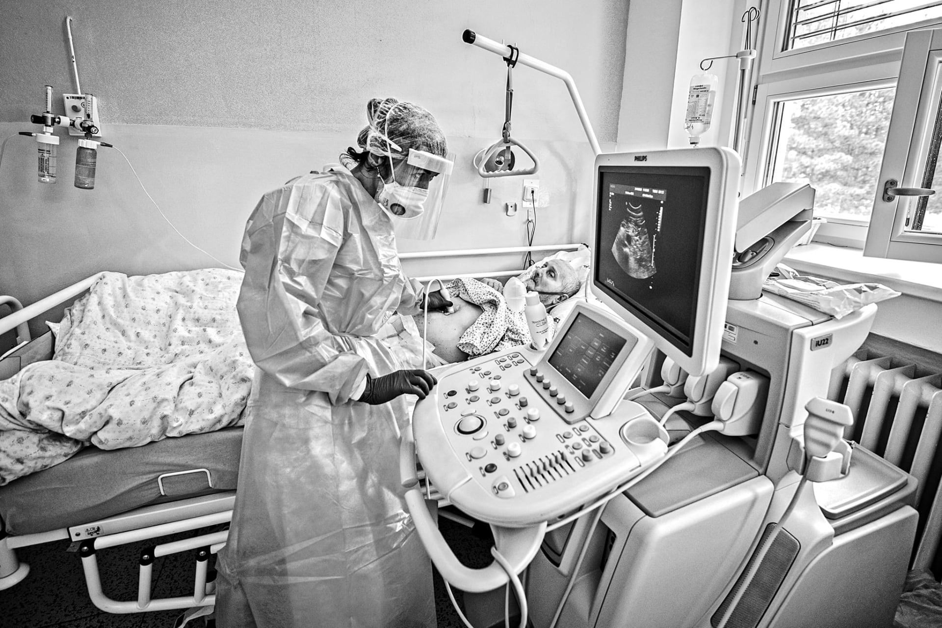 Kvůli koronavirové epidemii opět po 13 letech používají lékaři na odděleních mobilní ultrazvuk.