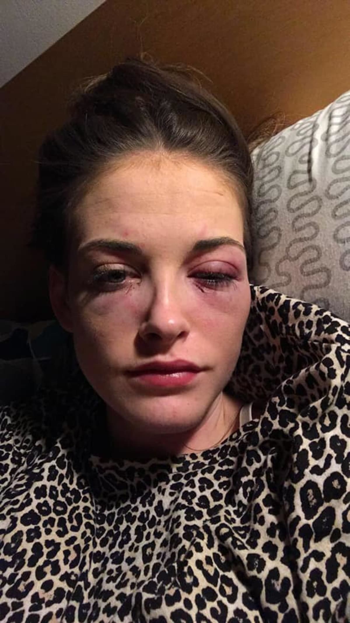 Paige Middlehurstová na Facebooku detailně popsala, jak jí přítel zbil do bezvědomí