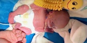Každé osmé dítě se rodí předčasně. Neonatologové zachraňují miminka už od 22. týdne