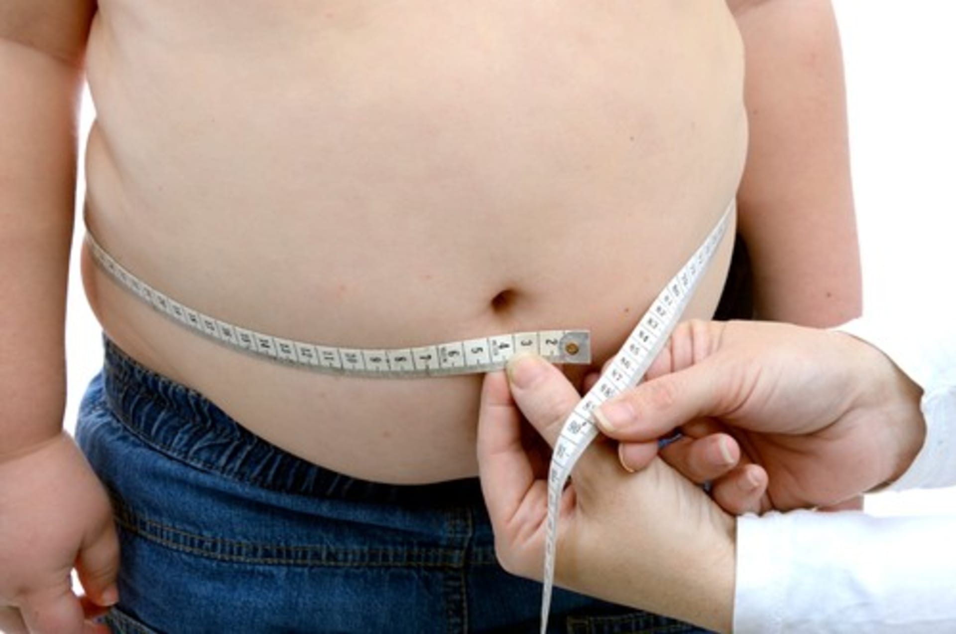 Vysoký podíl obézních lidí v Česku významně zatěžuje zdravotnictví. (Ilustrační foto)