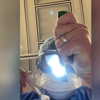 Lékař natočil video, ve kterém simuluje intubaci pacienta.
