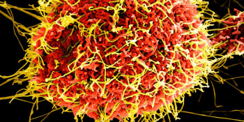 Rusko chce z viru eboly vytvořit smrtící biologickou zbraň, tvrdí evropští experti