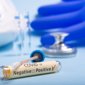 Pozitivní test na koronavirus