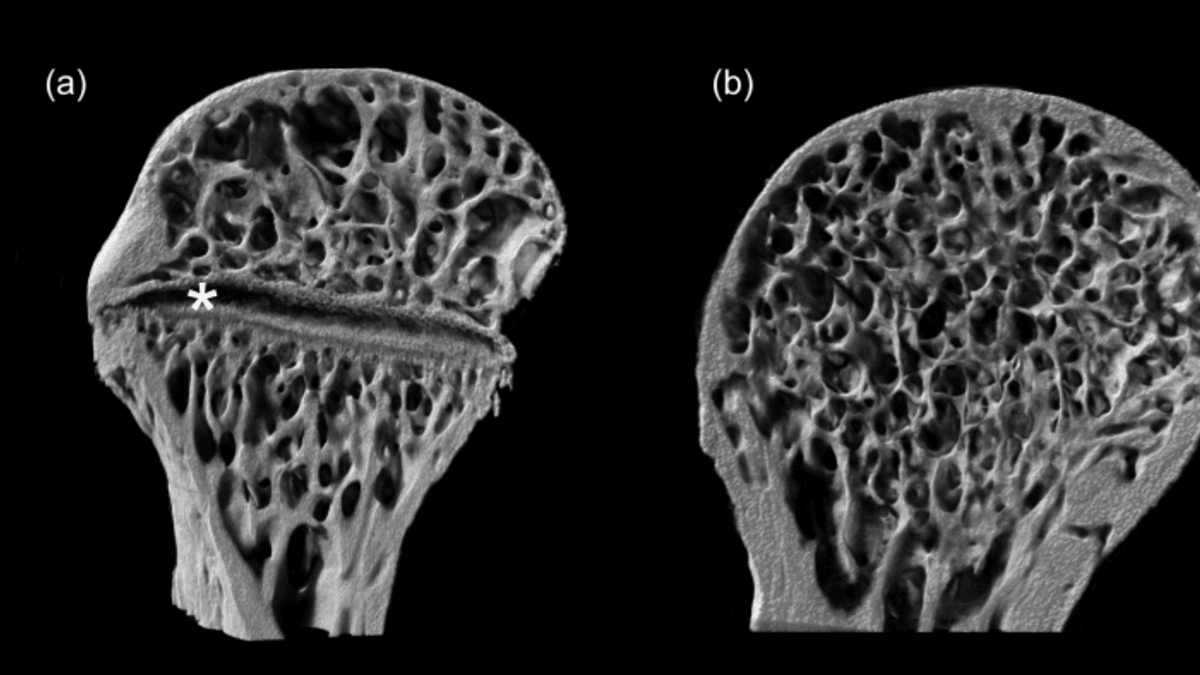 rentgenové mikrotomografie/ Zdroj: Petra Frýdlová,  Přírodovědecká fakulta UK