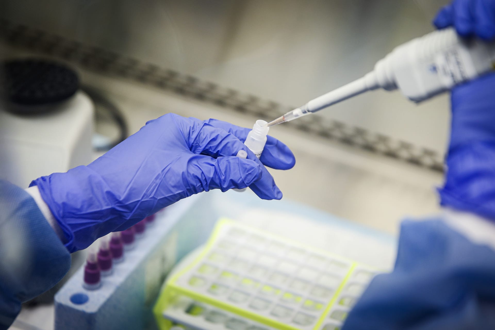 Laboratoře prověřují první podezřelé vzorky na jihoafrickou mutaci koronaviru.