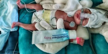 Žena porodila miminko do dlaně. Pepíček se narodil ve 23. týdnu těhotenství