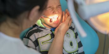 Chlapec se dostal do Guinnessovy knihy rekordů. Vytrhli mu nejdelší zub na světě