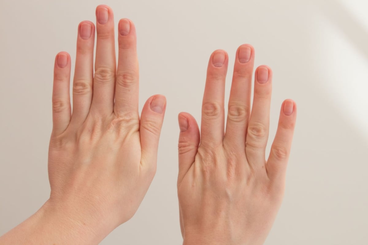 Odborníci zveřejnili několik příznaků prodělání covidu. Lidé by měli sledovat své nehty, mohou jim napovědět. (Ilustrační snímek)