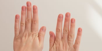 Sledujte své nehty, radí odborníci. Zveřejnili pět příznaků prodělání covidu