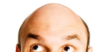 Neobvyklé příznaky omikronu: Nakažení hlásí vypadávání vlasů i zánět spojivek