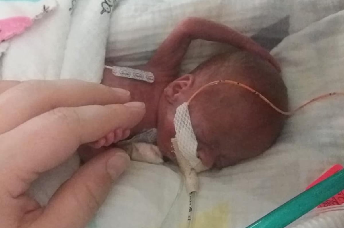 Chlapec se po narození vešel do jedné dlaně. (Autor: Guinness world records)