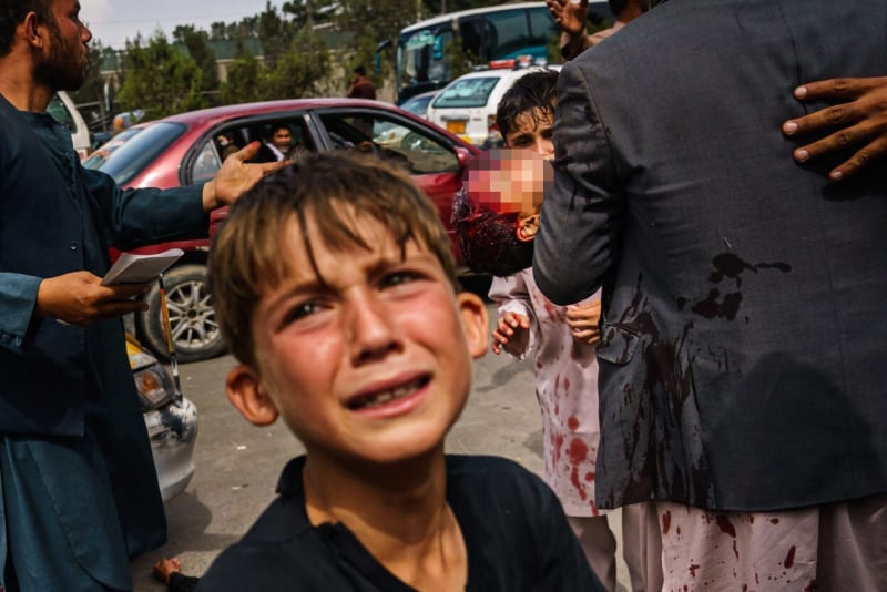 Děti v Afghánistánu se v současnosti musí bát o své životy.