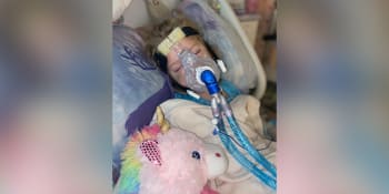 Noční můra rodičů: Tříletá holčička skončila na dýchacím přístroji kvůli covidu