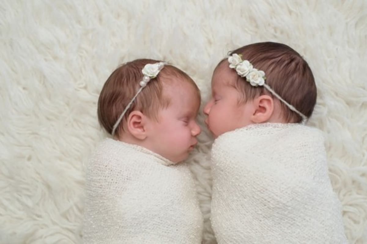 Unikátní dvojčata se narodila páru z amerického Rochesteru v New Yorku. (Ilustrační foto)