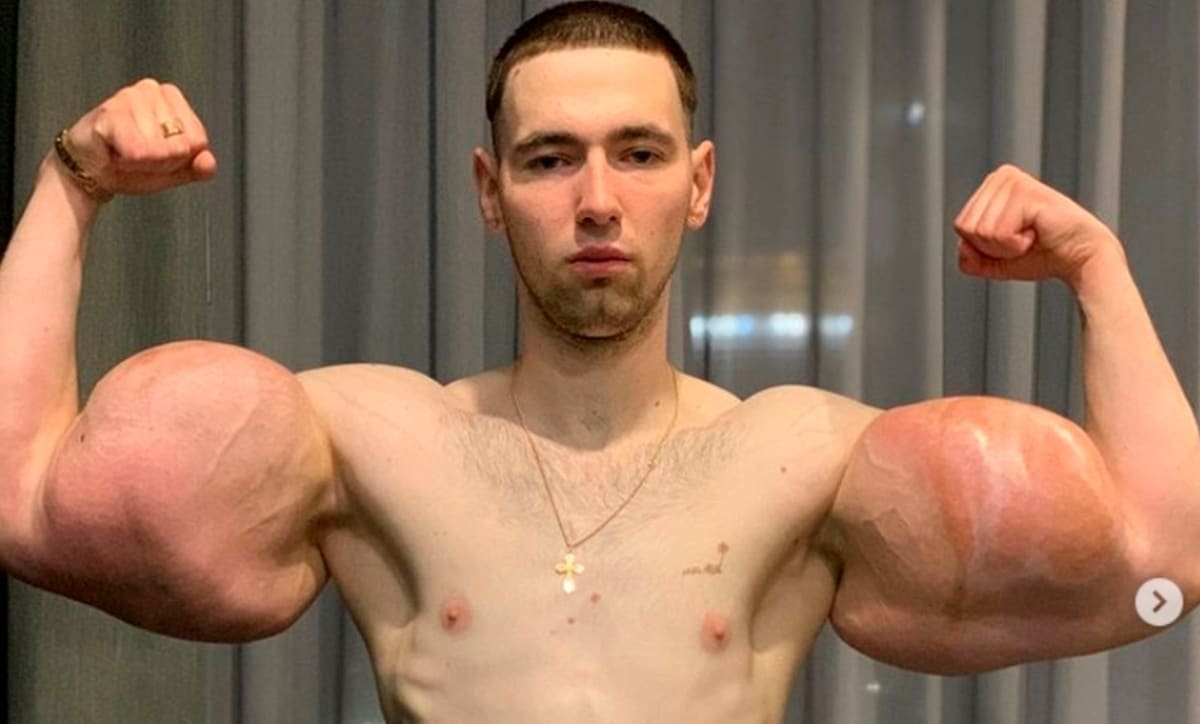 Kirill Terešin si cestu na velkými svaly značně zkrátil.