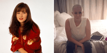 Děsivé fotky z boje s rakovinou: „Brenda“ z Beverly Hills ukázala, co jí nemoc způsobila