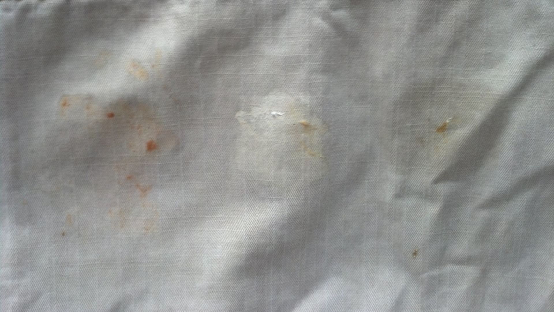 Odstranění skvr od kečupu hořčice a omastku - Obrázek 3