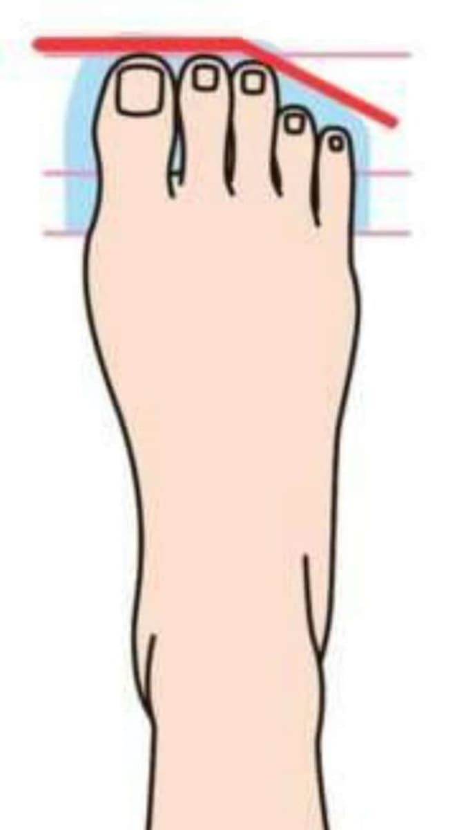 Typy nohou - Obrázek 1