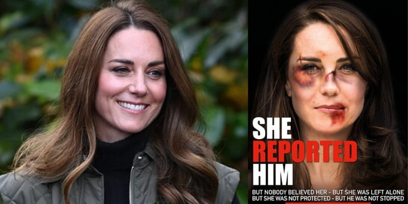Internet obletěly šokující snímky vévodkyně Kate, na kterých má rozbitou tvář.