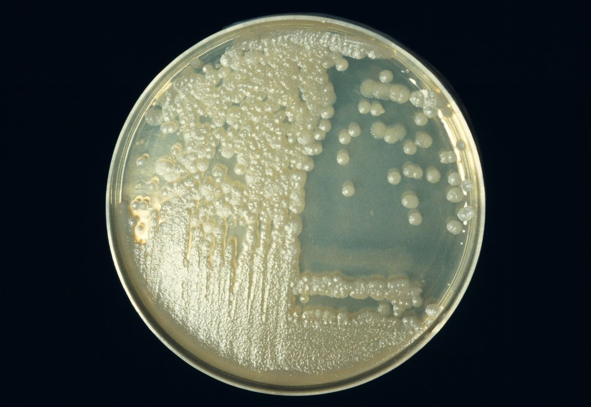 Bakterie antraxu na Petriho misce.