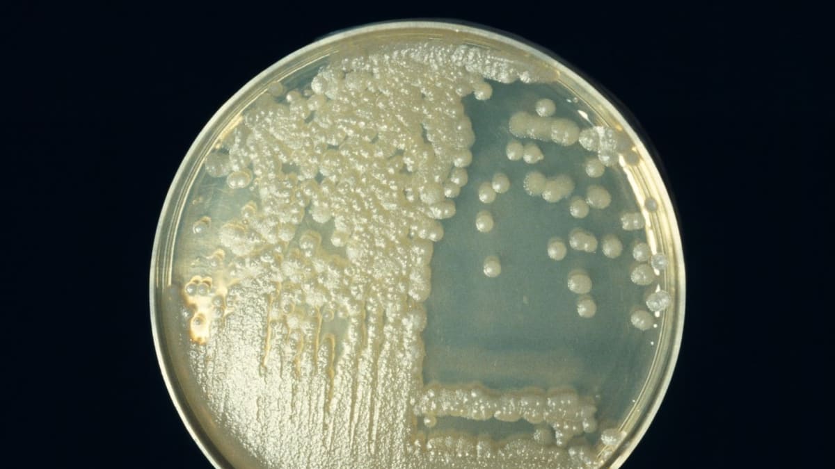 Bakterie antraxu na Petriho misce.