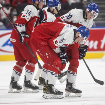 Čeští hokejisté do 20 let na MS v Kanadě, zraněný David Jiříček 