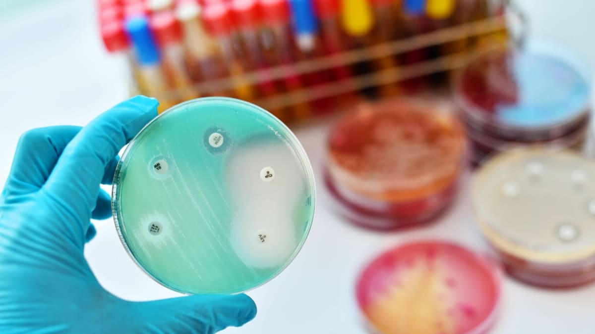 Superbakterie představují obrovskou výzvu pro světovou medicínu. Nadužívání antibiotik způsobilo jejich zvyšující se neúčinnost.