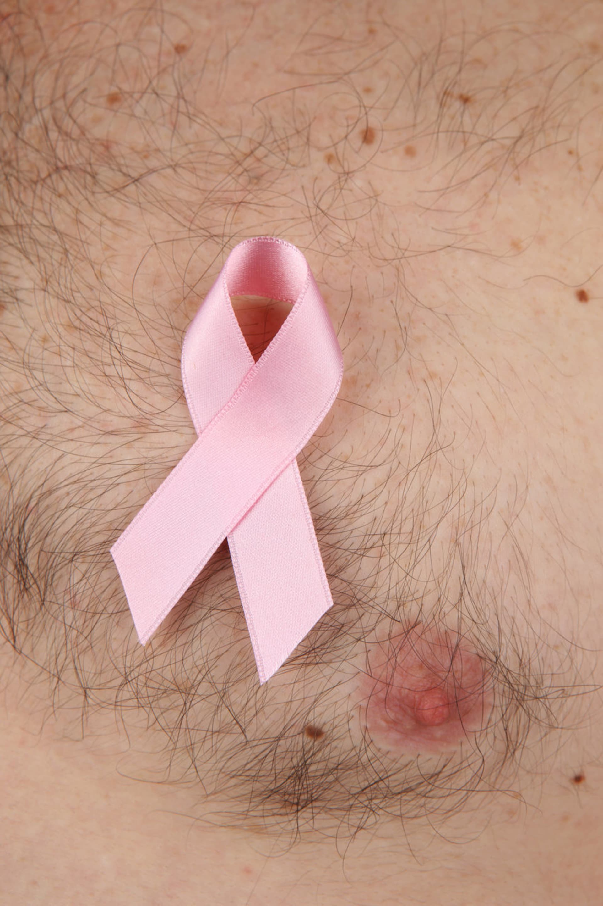muži bradavky - muži rakovina prsu