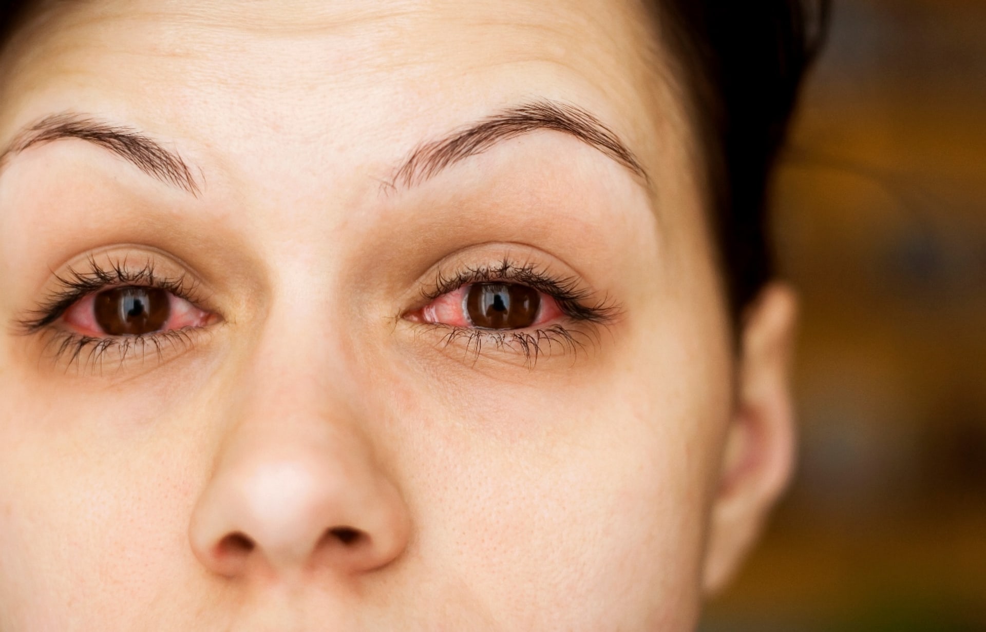 Oční alergie může propuknout kdykoli. Co dělat, když se objeví?