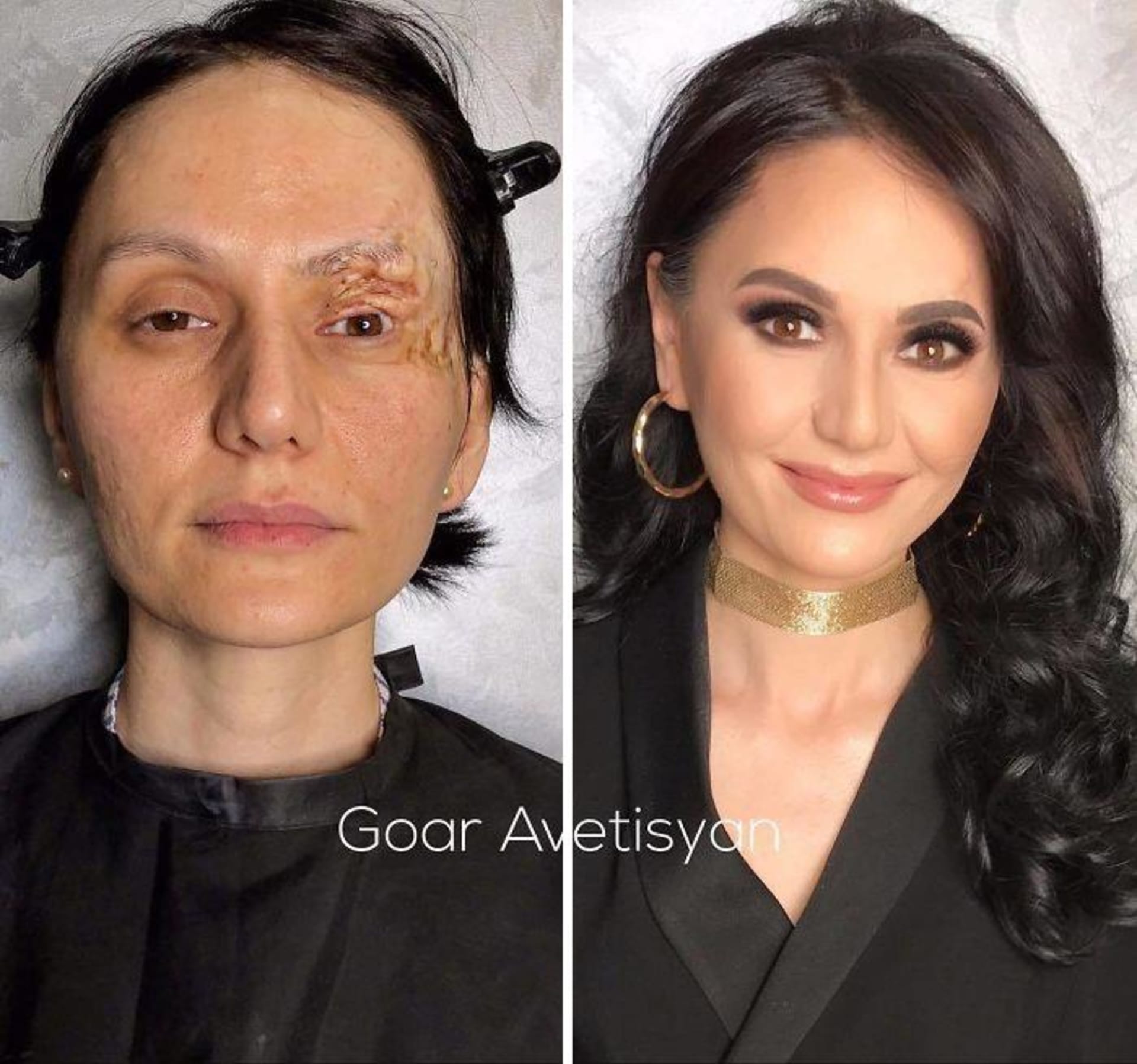 Make-up artistka zvědá sebevědomí ženám s jizvami  5