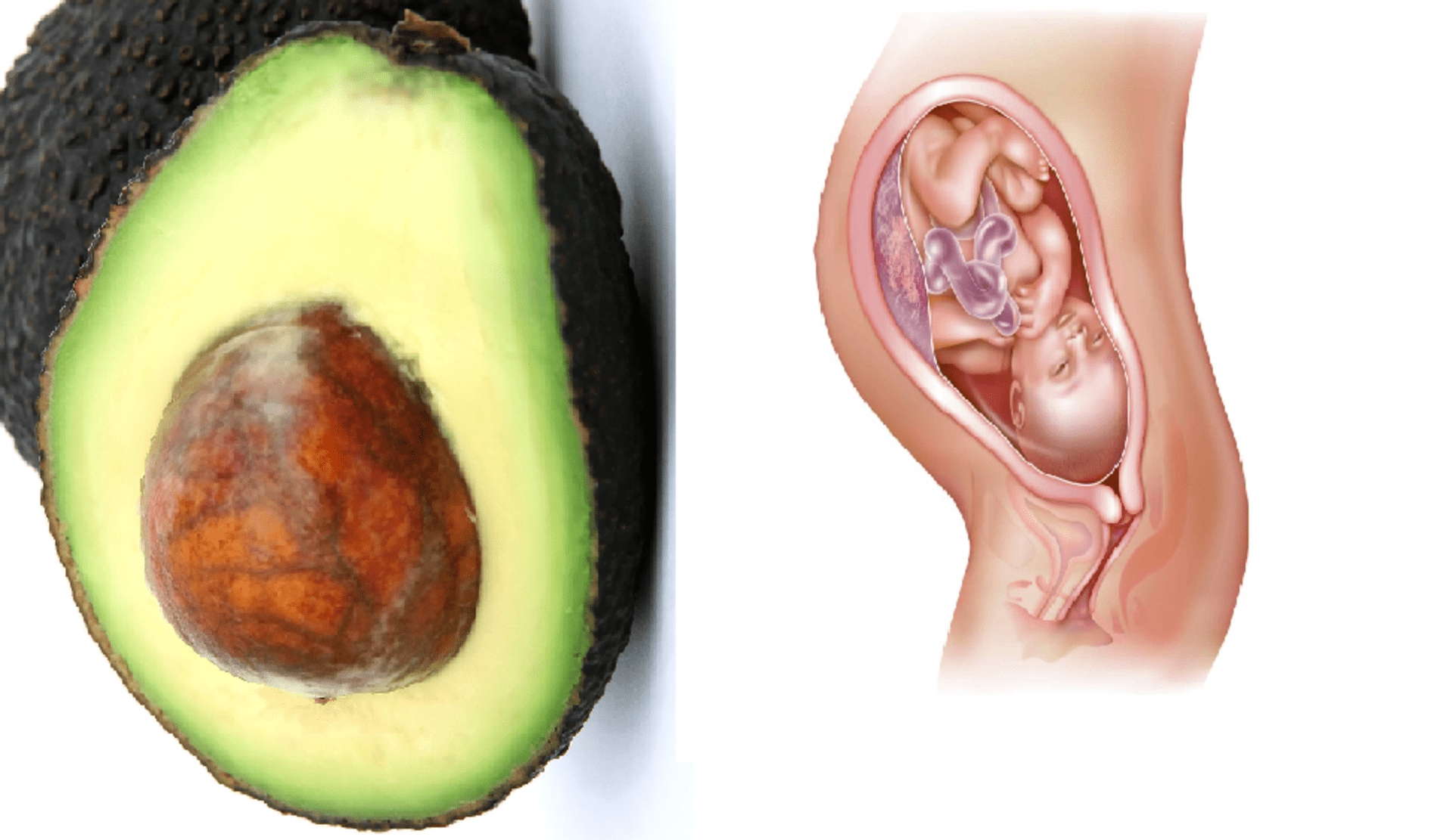 Avokádo a ženská děloha