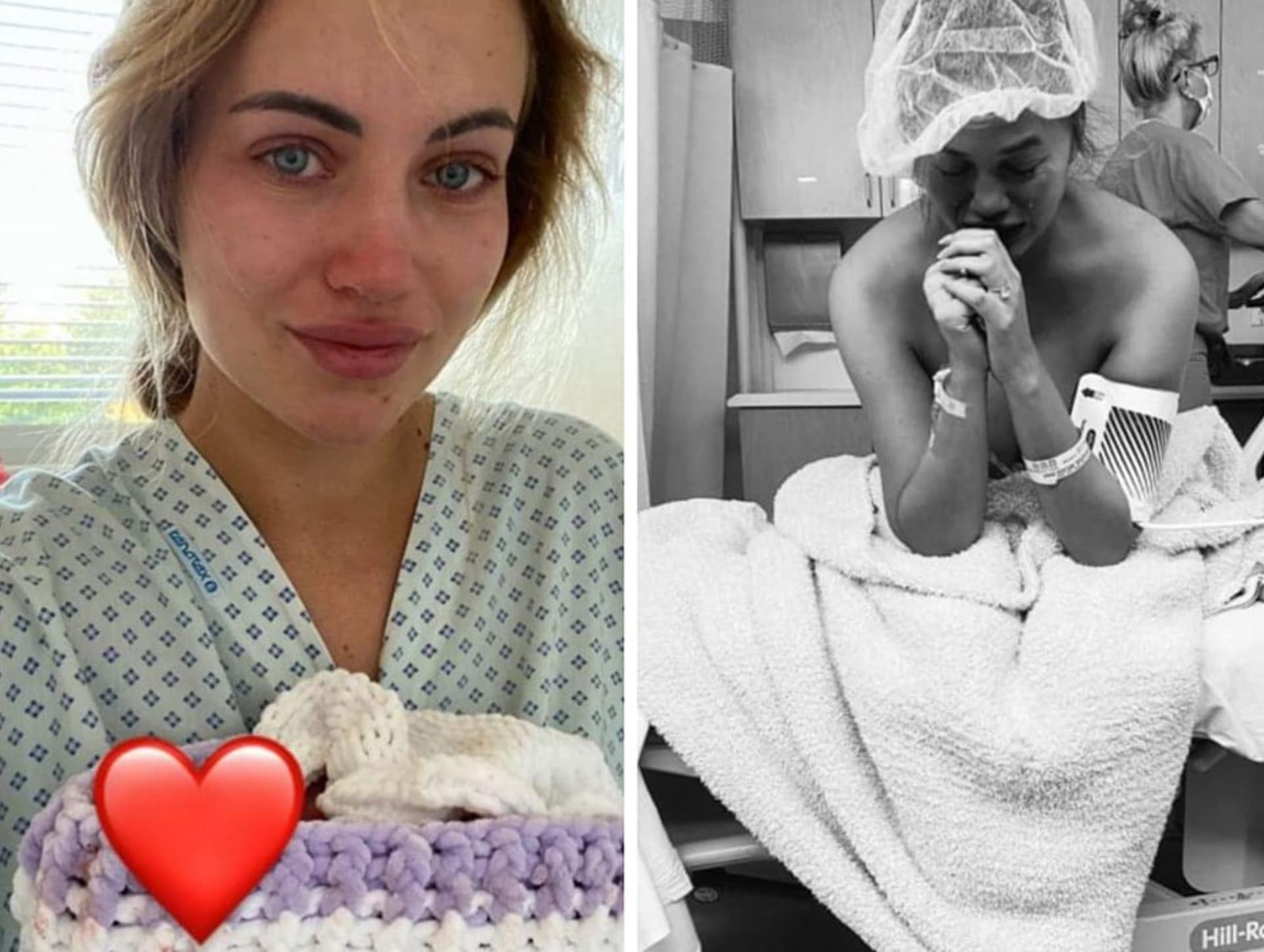 Modelky Chrissy Teigen a Natálie Kočendová. Obě mají zkušenost s potratem miminka a nebály se o ní promluvit.