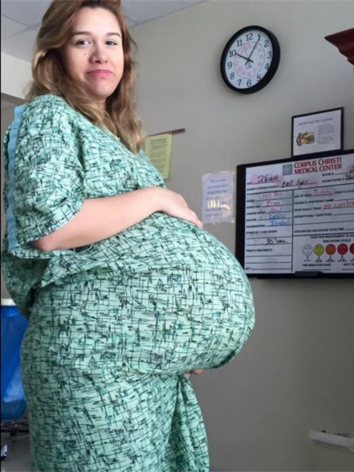 Maminka Silvia Hernadez (23 let) se o tom, že čeká trojčata, z čehož dvě jsou srostlá, dozvěděla ve třetím měsíci těhotenství.