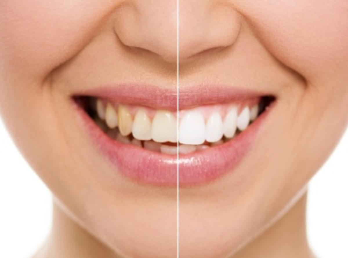 Zdravé a krásné zuby vám nejen dodají sebevědomí, ale také rozhodují o celkovém zdraví organismu