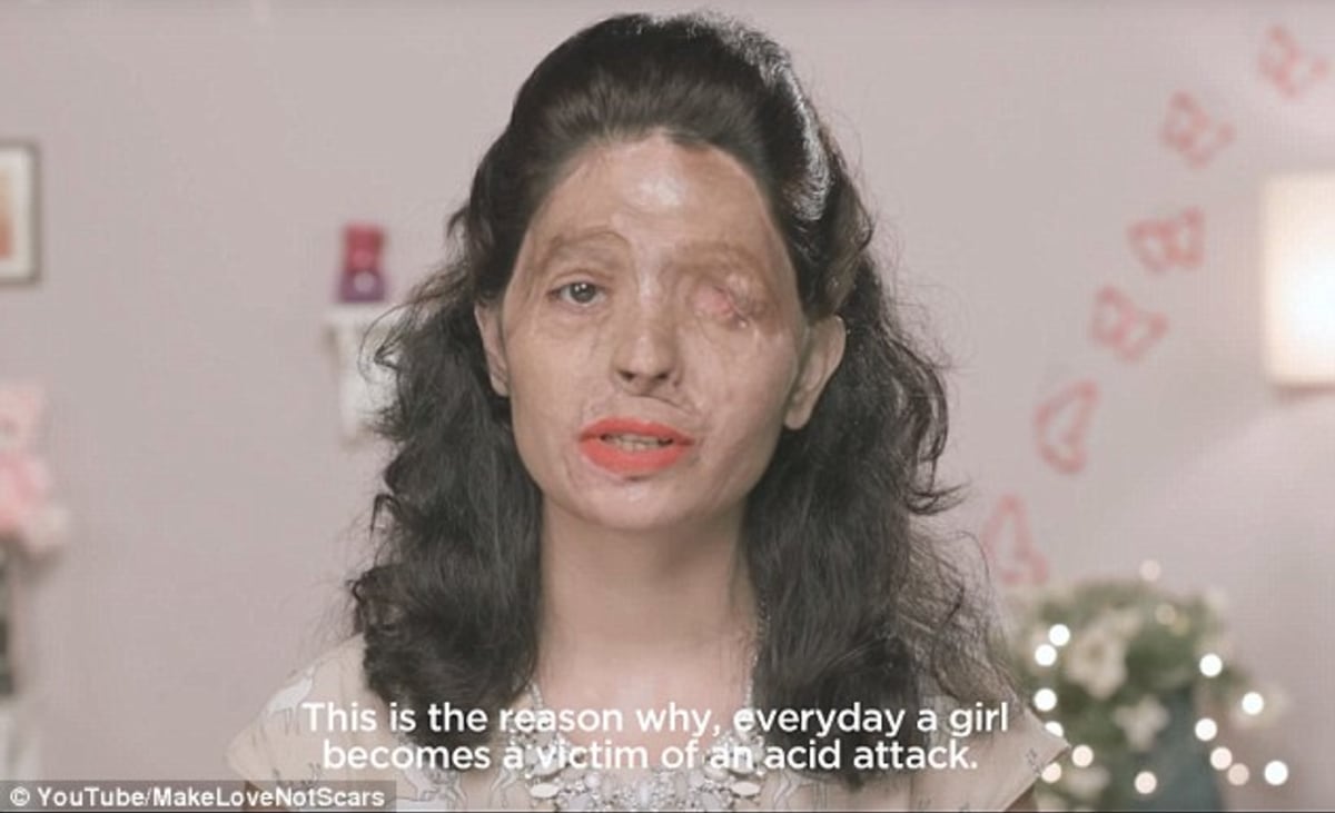 Reshma má znetvořený obličej kyselinou - Obrázek 1